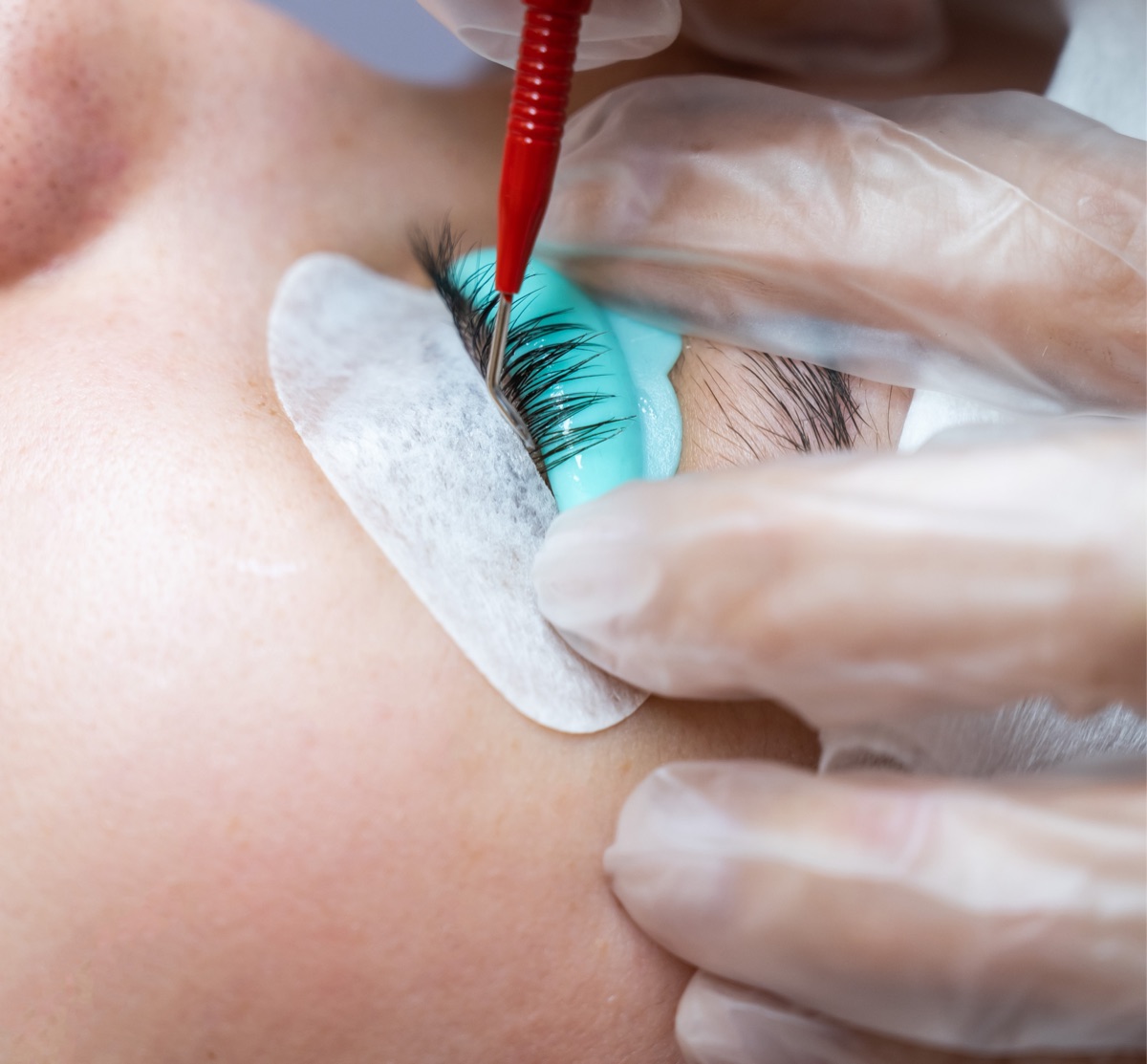 Lash infill treatment